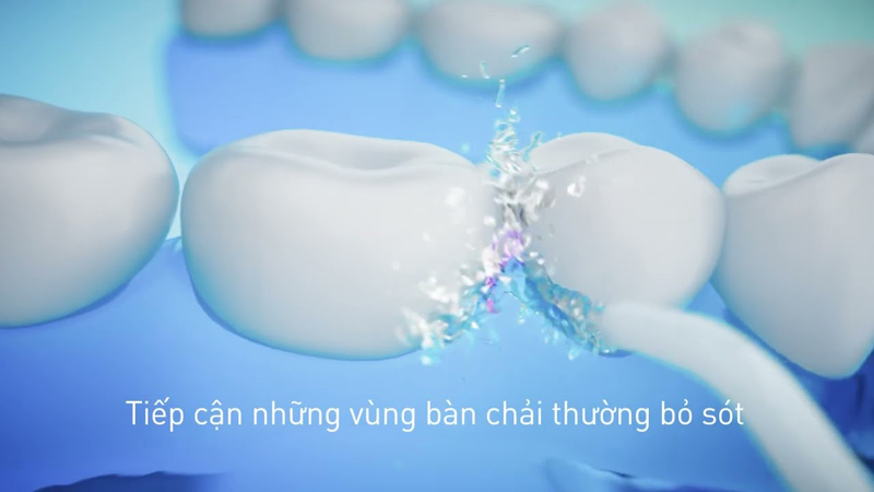 Công nghệ siêu âm làm sạch sâu, loại bỏ mảng bám hiệu quả