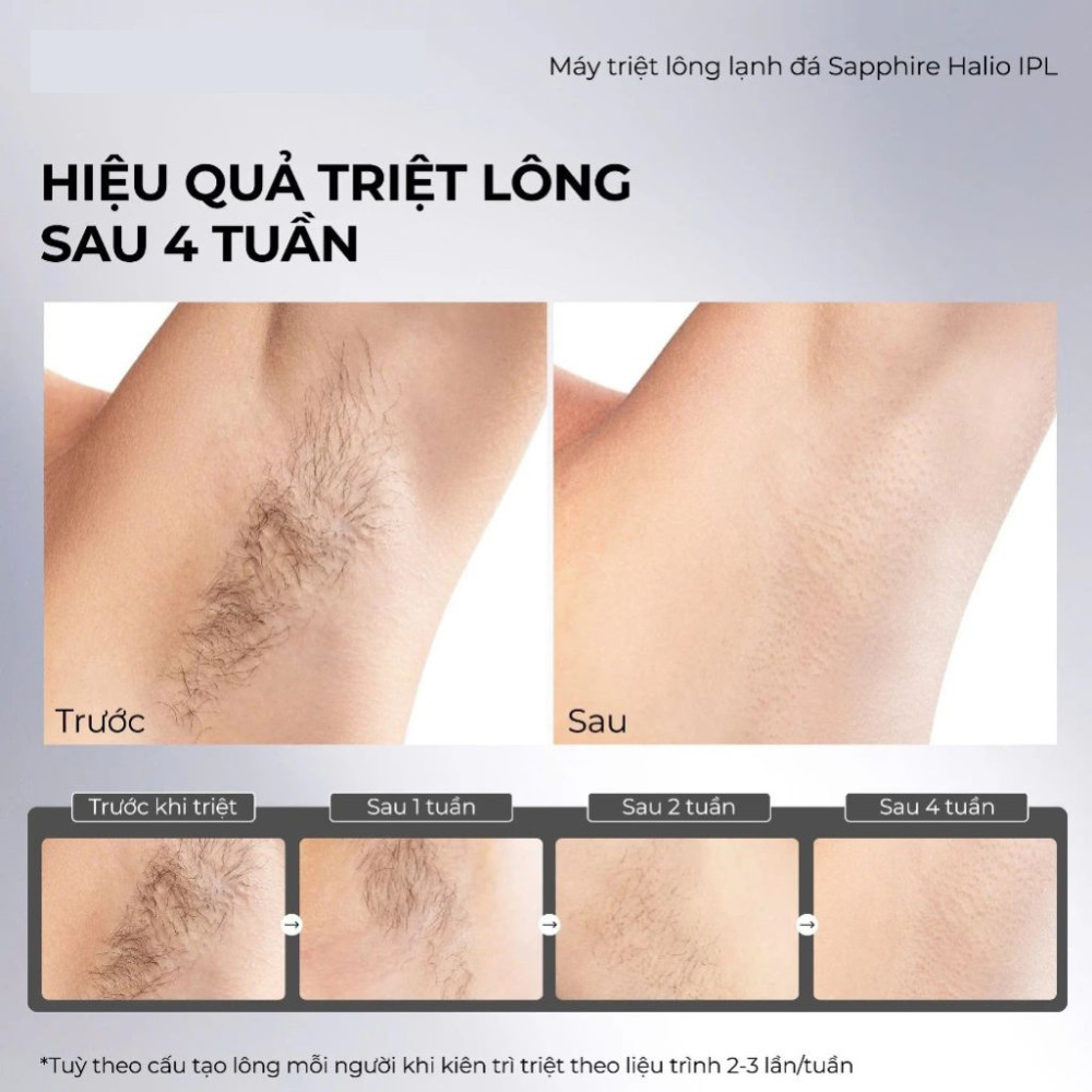 Máy triệt lông lạnh Sapphire Halio InfinityGlow Advanced IPL Sapphire Cooling Hair Removal Device - Hàng chính hãng